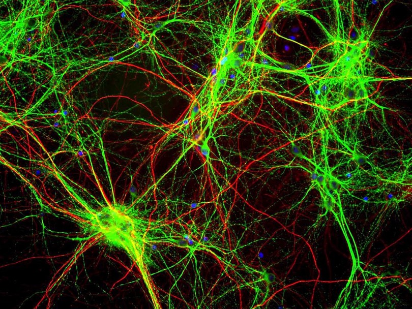 brain-cells-jason-dias
