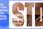 chances of getting an STD